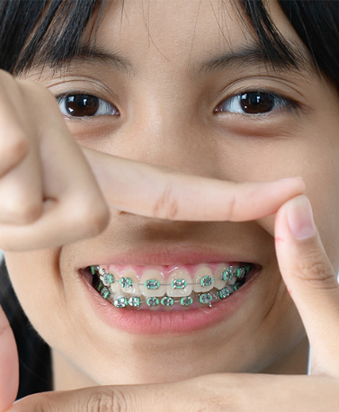 braces treatment in ghatkopar