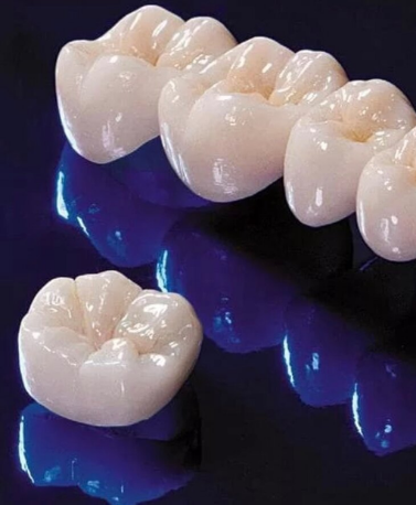 Dental Crowns & Bridges in Ghatkopar