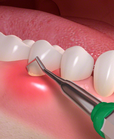 Gum Treatment in ghatkopar