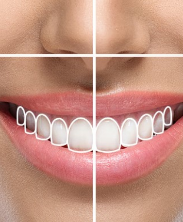 Cosmetic Smile Designing Treatment in Ghatkopar