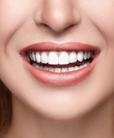 smile makeover in ghatkopar smile makeover in ghatkopar