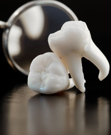 wisdom tooth removal in ghatkopar wisdom tooth removal in ghatkopar