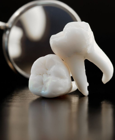 wisdom tooth removal in ghatkopar